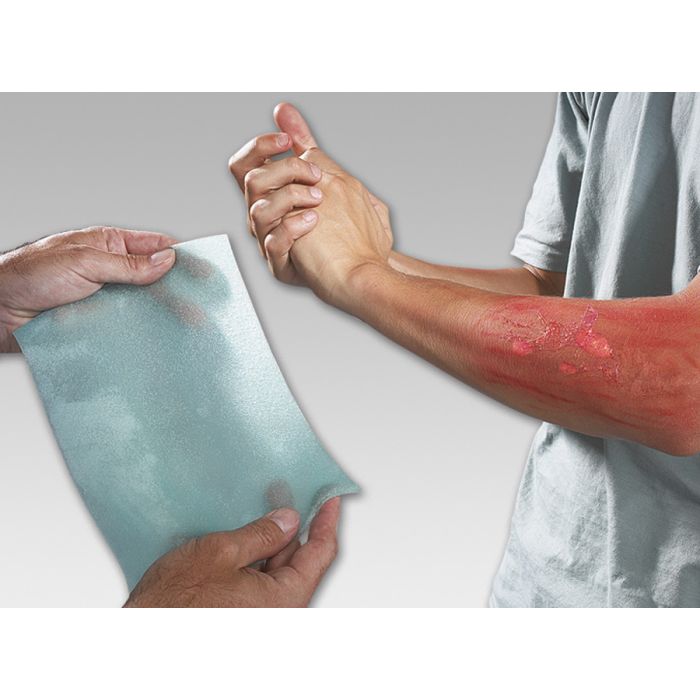 95750 Hydrogel Burnfree, 20 x 3,5 g - MELTEC GmbH